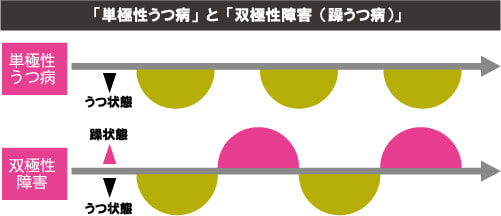 「単極性うつ病」と「双極性障害(躁うつ病)」